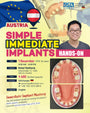 Austria) Simple Immediate Implants Hands-on [2026/11/1]