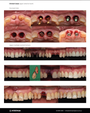 Sydney, Australia) Advanced Immediate Implant Course [2026/8/8 ~ 8/9]