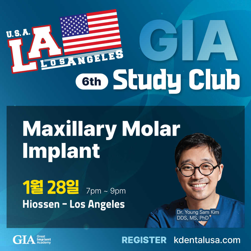 Los Angeles GIA Study Club) Maxillary Molar Implant [2025/1/28]