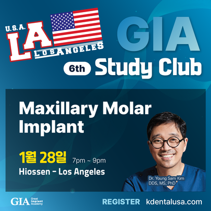 Los Angeles GIA Study Club) Maxillary Molar Implant [2025/1/28]
