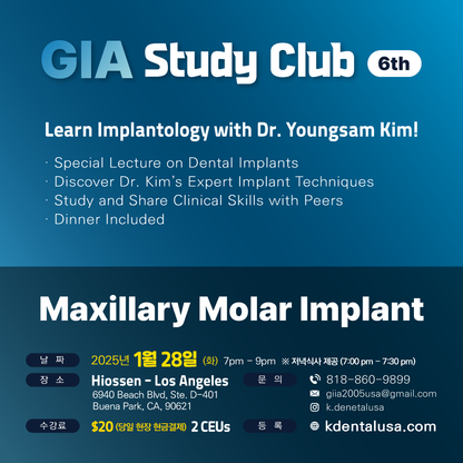 Los Angeles GIA Study Club) Maxillary Molar Implant [2025/1/28]