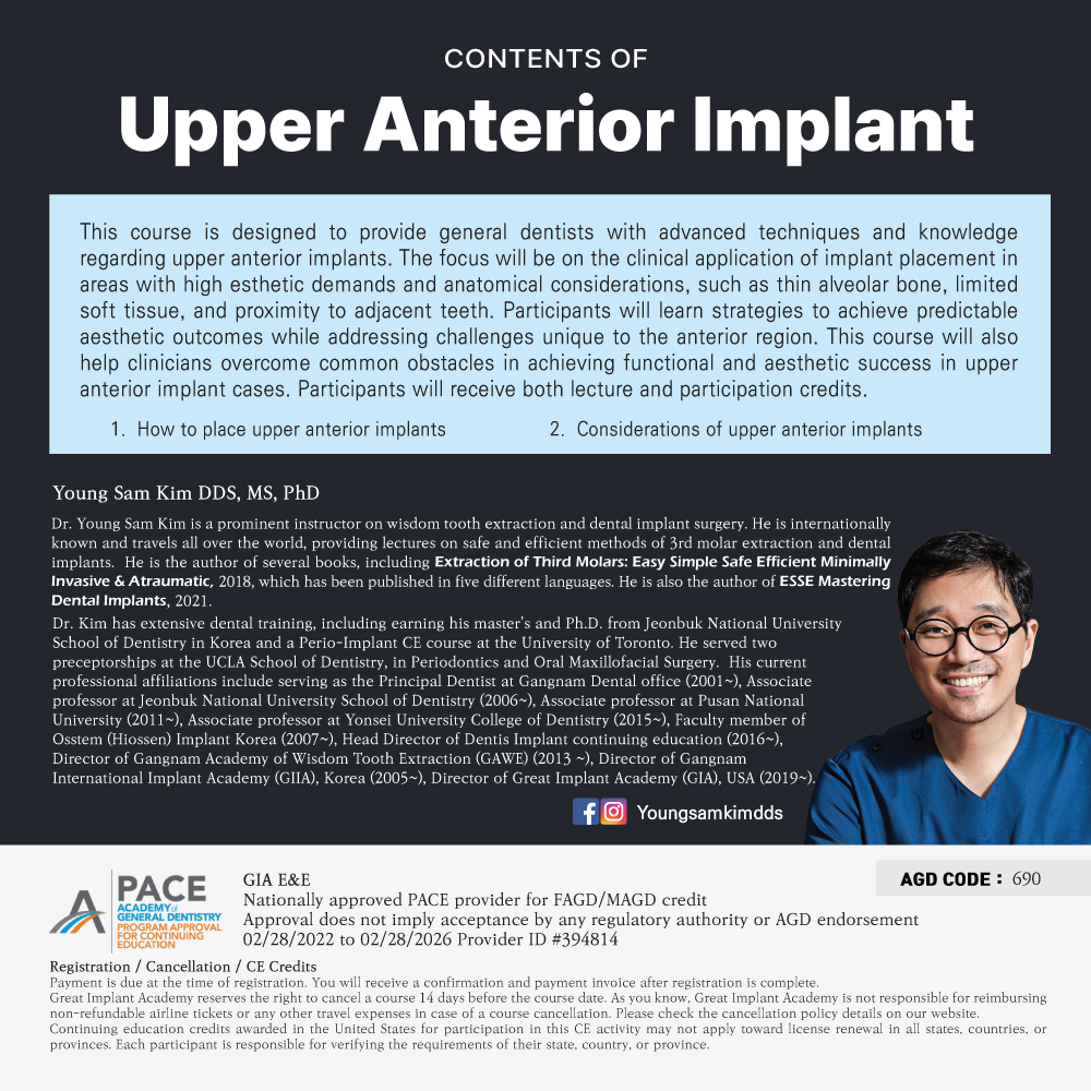 Los Angeles GIA Study Club) Upper Anterior Implant [2025/2/4]