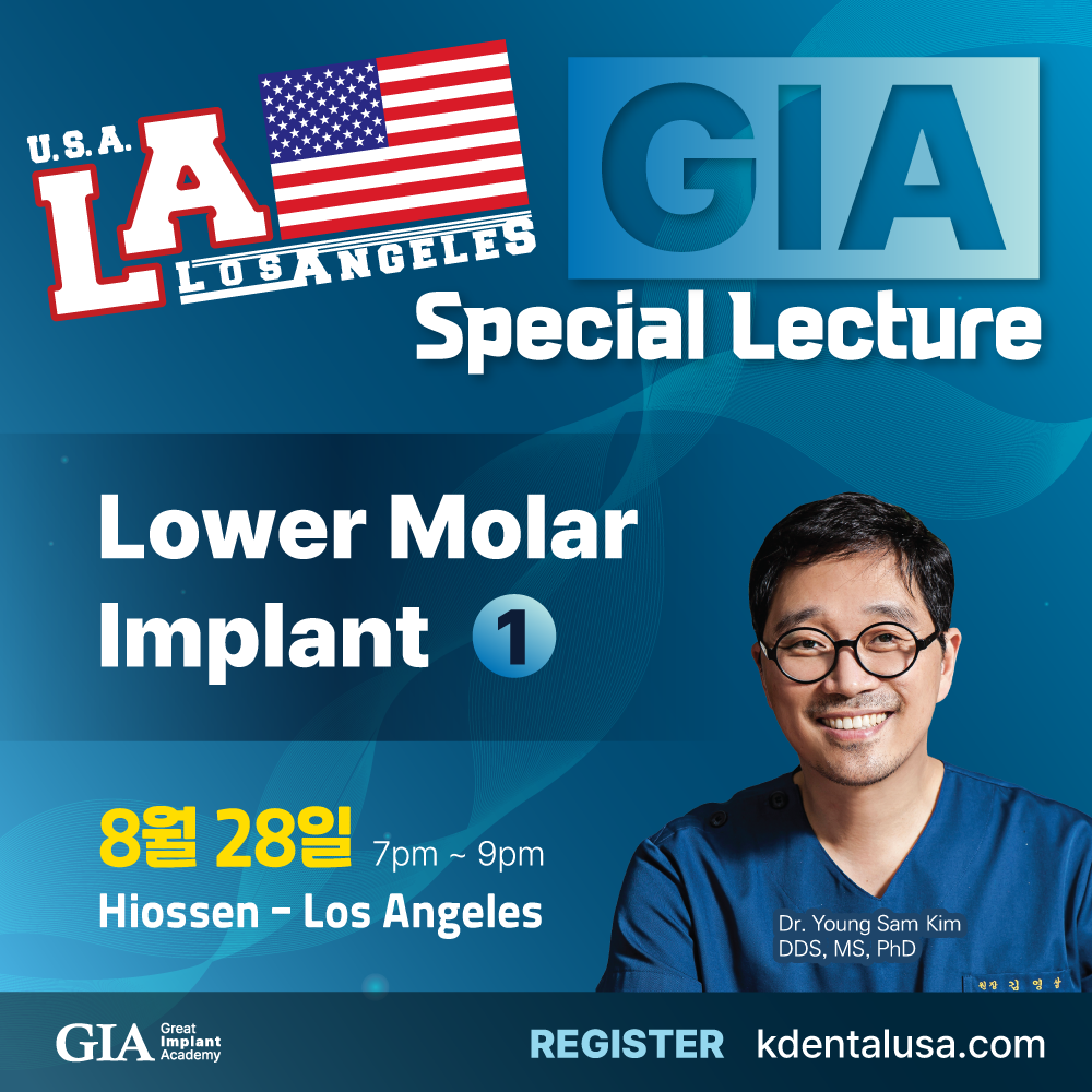 Los Angeles GIA Special) Lower Molar Implant - 1 [2024/08/28]