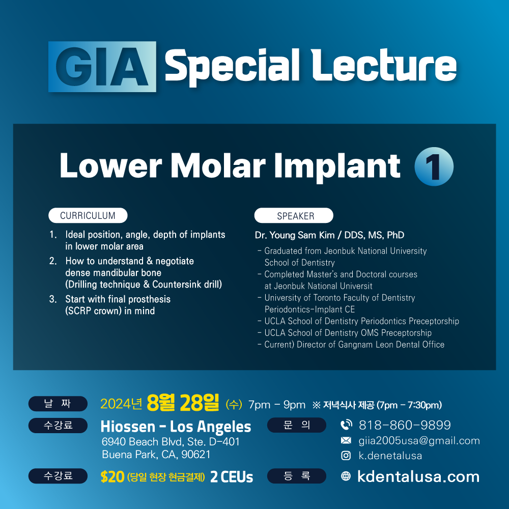 Los Angeles GIA Special) Lower Molar Implant - 1 [2024/08/28]