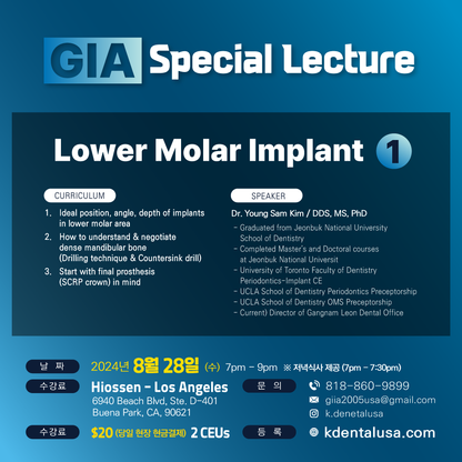 Los Angeles GIA Special) Lower Molar Implant - 1 [2024/08/28]