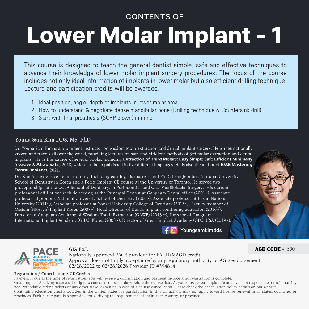 Los Angeles GIA Special) Lower Molar Implant - 1 [2024/08/28]