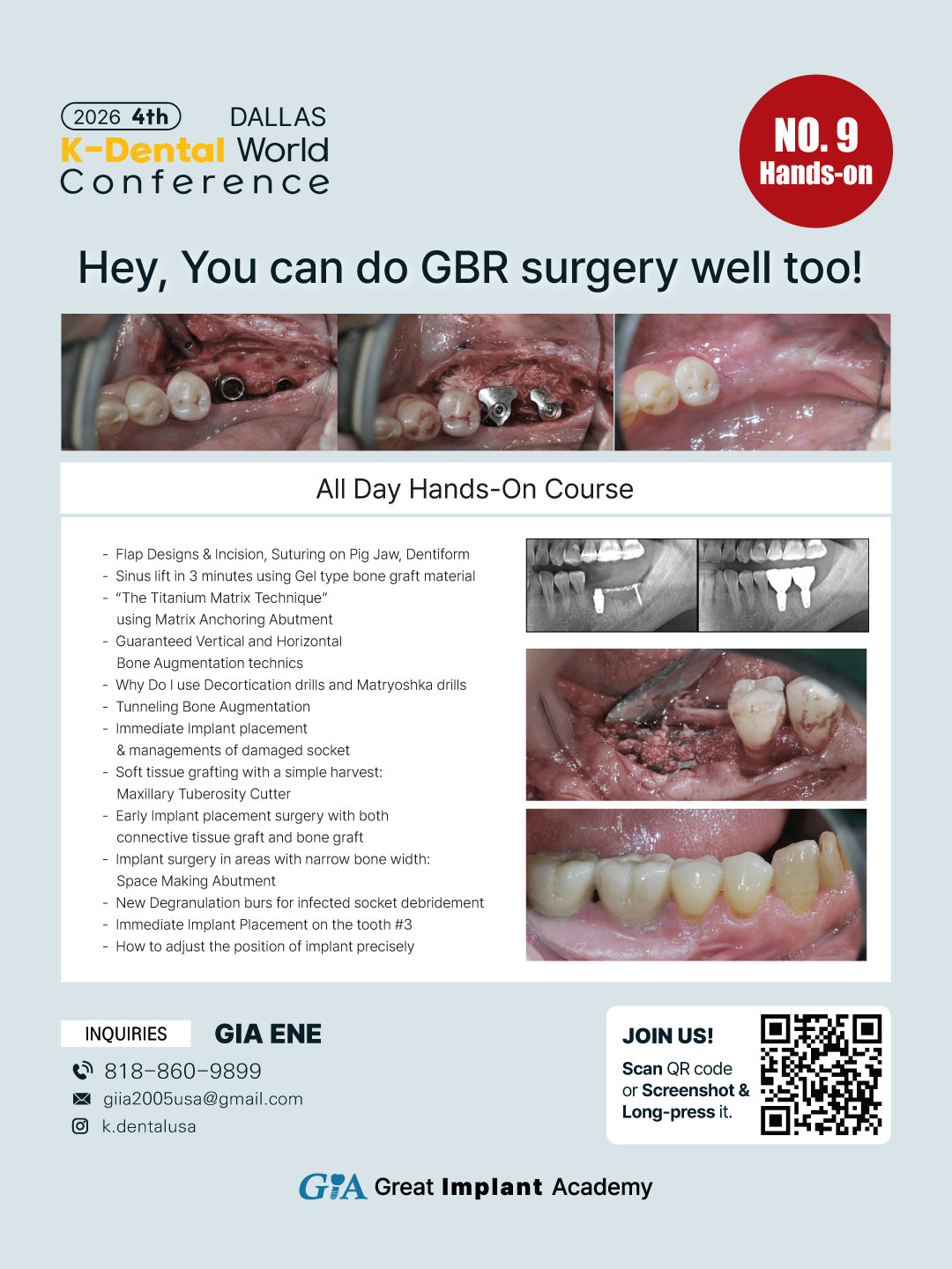 KDWC 2026 Dallas - No.9) Hey, You Can Do GBR Surgery Well Too! Hands-on [Sun]