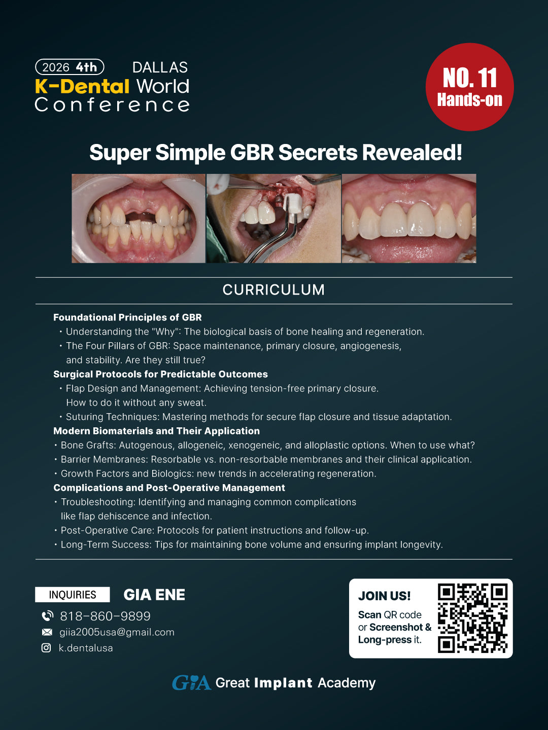 KDWC 2026 Dallas - No.11) Super Simple GBR Secreats Revealed! Hands-on [Sat]