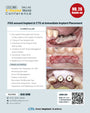 KDWC 2026 Dallas - No.26) FGG Around Implant & CTG at Immediate Implant Placement Hands-on [Sat]