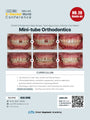 KDWC 2026 Dallas - No.20) Mini-Tube Orthodontics: Partial Orthodontics made Simple Hands-on [Sat]