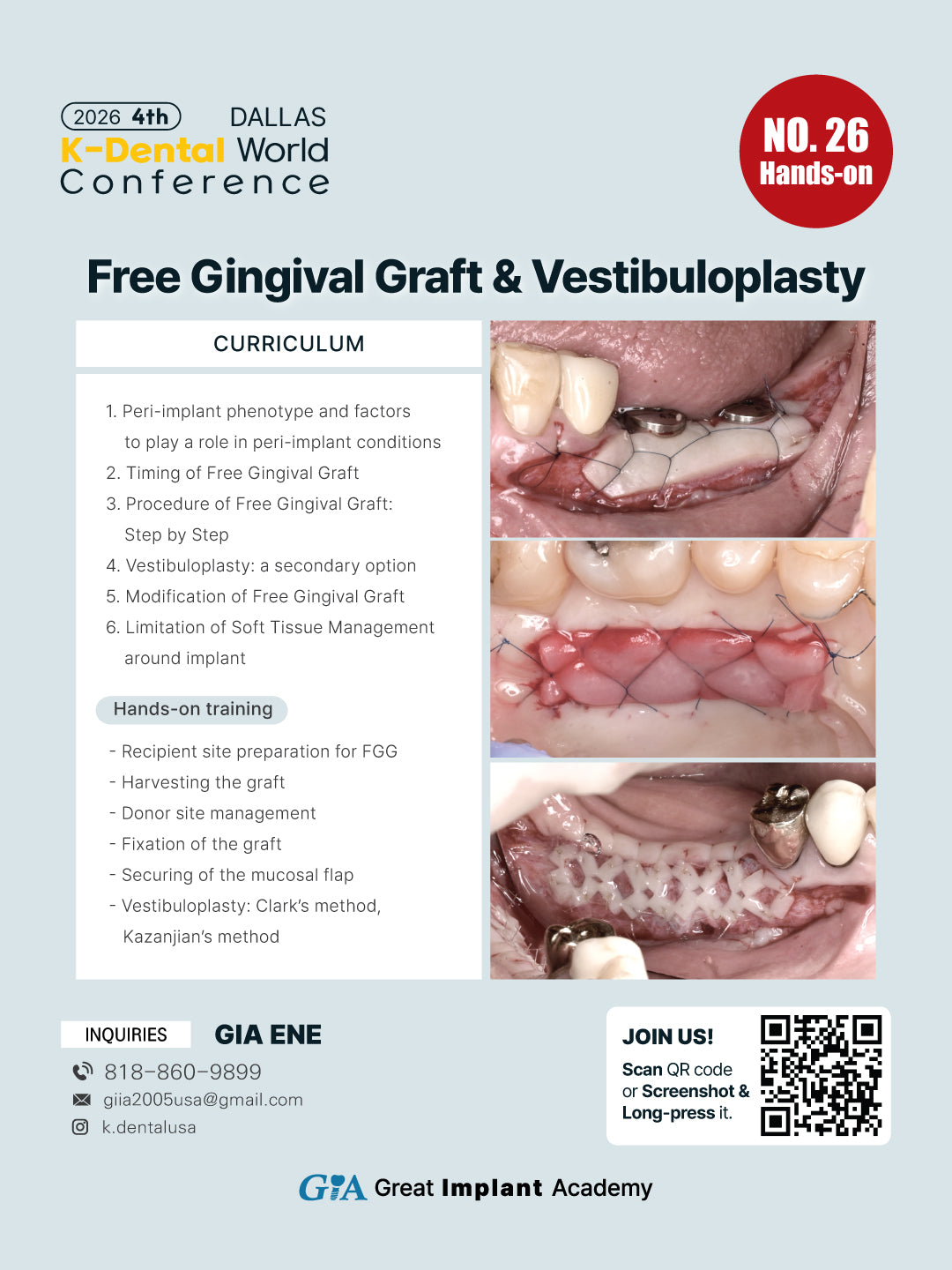 KDWC 2026 Dallas - No.26) Free Gingival Graft & Vestibuloplasty Hands-on [Sat]