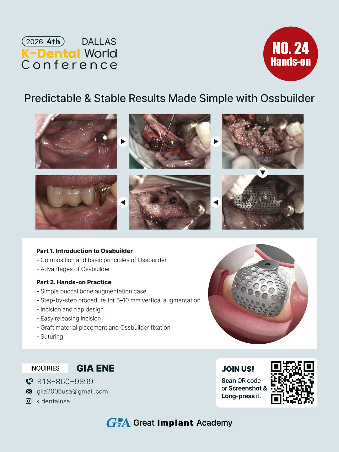 KDWC 2026 Dallas - No.24) Predictable & Stable Results Made Simple with Ossbuilder Hands-on [Sun]