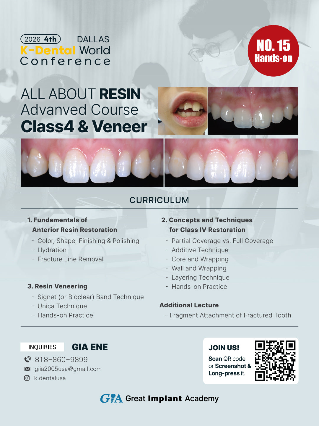 KDWC 2026 Dallas - No.15) All About Resin: Class 4 & Veneer Hands-on [Sun]