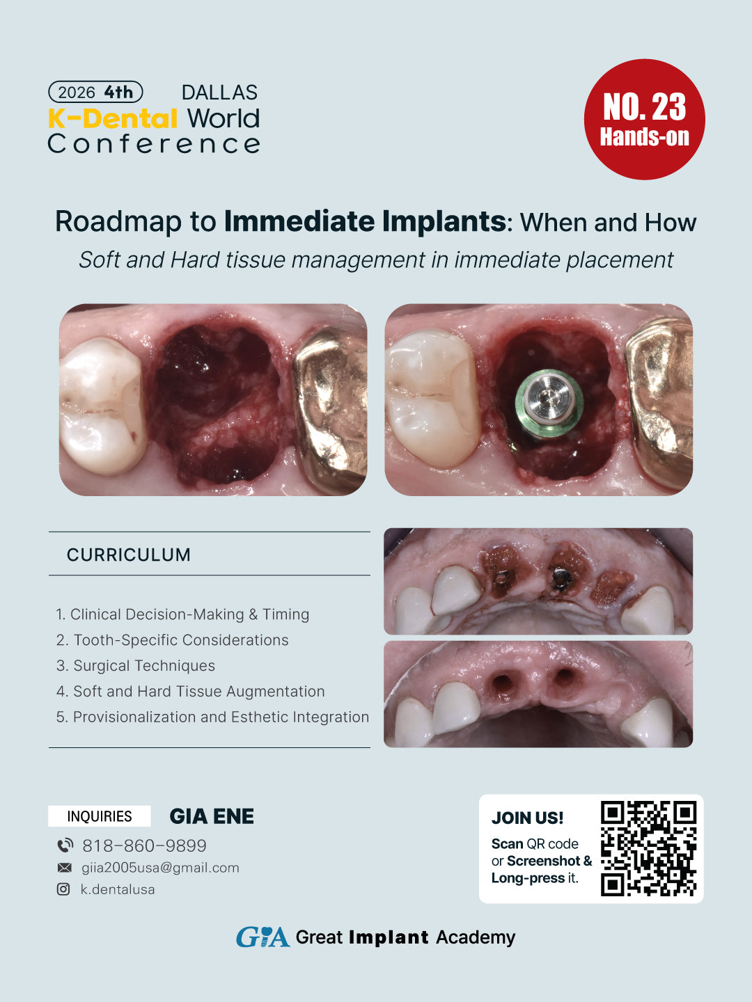 KDWC 2026 Dallas - No.23) Roadmap to Immediate Implants: When and How Hands-on [Sat]
