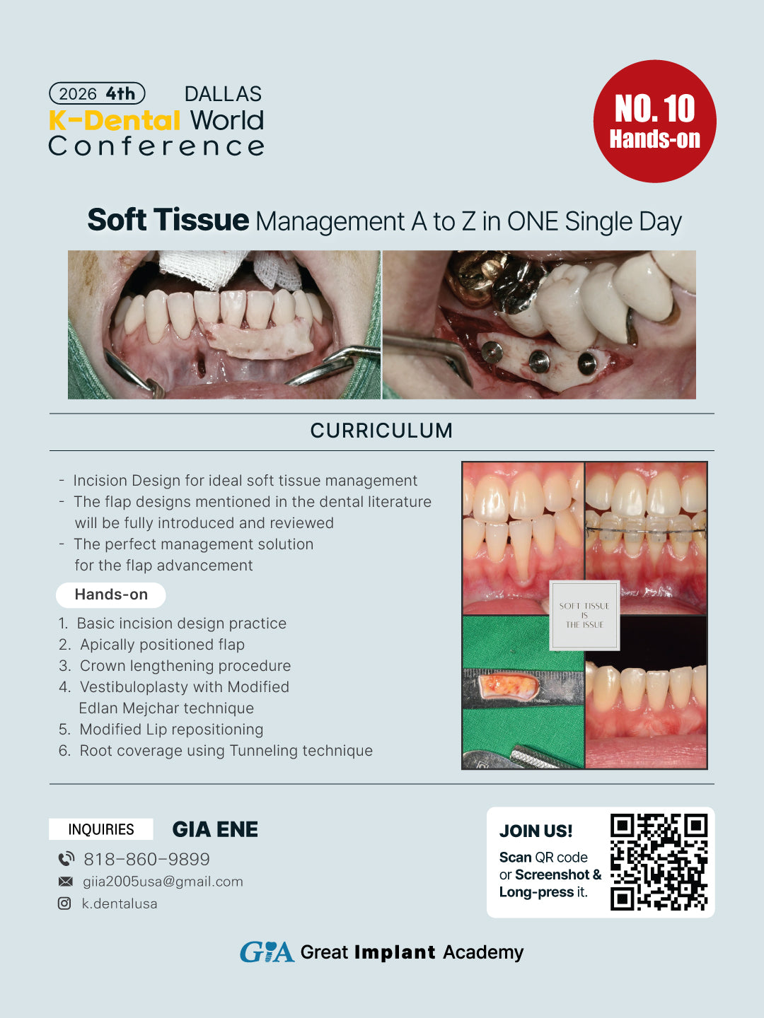 KDWC 2026 Dallas - No.10) Soft Tissue Management A to Z in One Single Day [Fri]