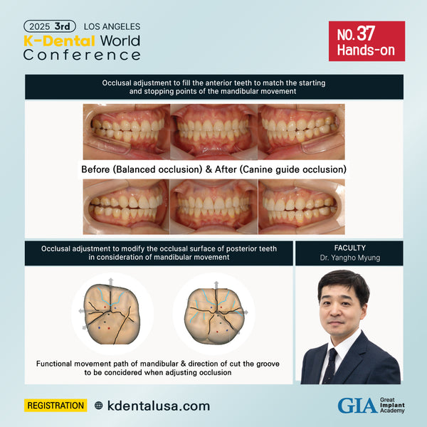 KDWC 2025 Los Angeles - No.37) Occlusal Adjustment for Treatment of Fixed Prosthodontics HANDS-ON [Sun]