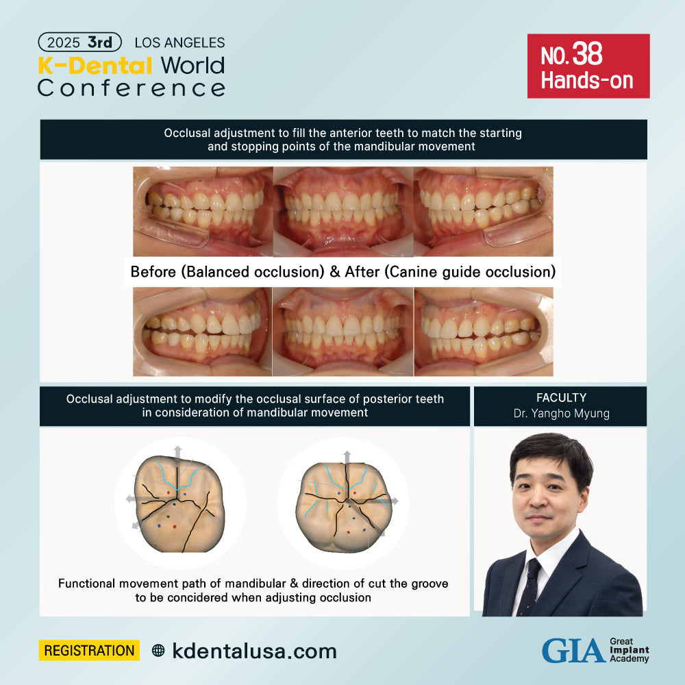 KDWC 2025 Los Angeles - No.38) Occlusal Adjustment for Treatment of Fixed Prosthodontics HANDS-ON [Sun]