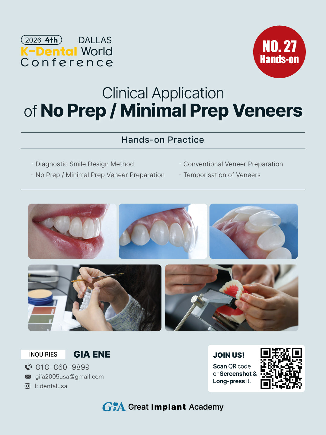 KDWC 2026 Dallas - No.27) Clinical Application of No Prep / Minimal Prep Veneers Hands-on [Sun]