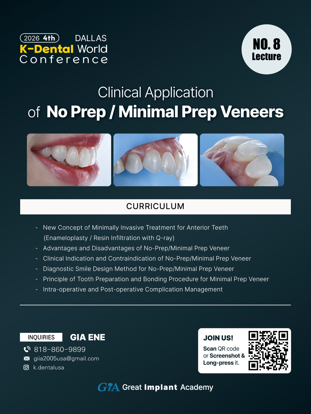 KDWC 2026 Dallas - No.8) No Prep / Minimal Prep Veneers: Clinical Application [Sat]