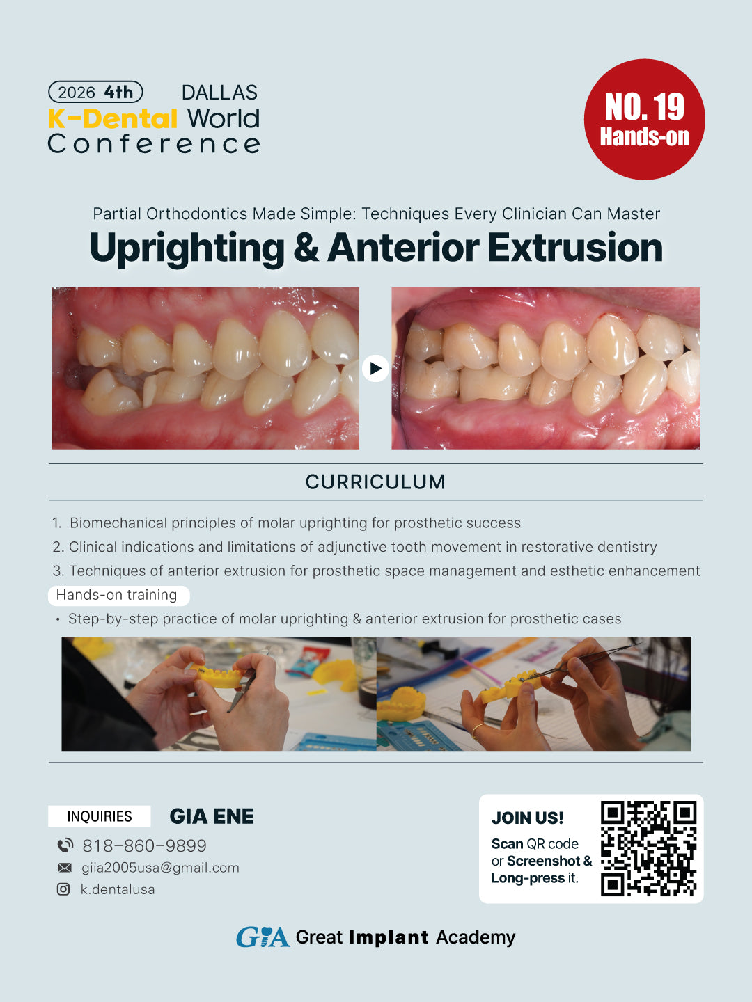 KDWC 2026 Dallas - No.19) Molar Uprighting & Anterior Extrusion: Partial Orthodontics Made Simple Hands-on [Fri]