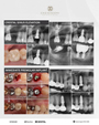 Sydney, Australia) Mastering Immediate Implants and Sinus Lift [2025/8/15 ~ 8/17]
