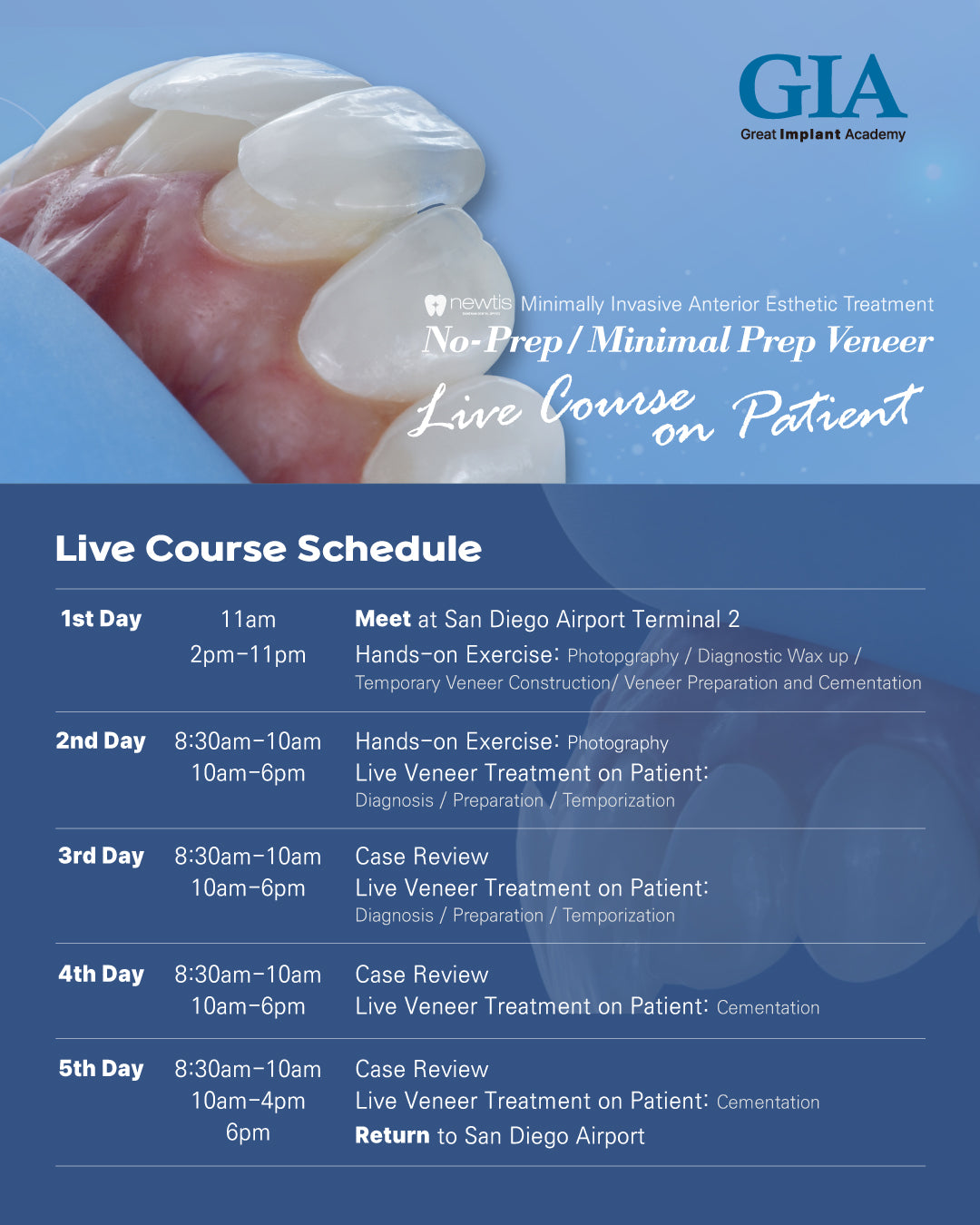 Mexico) No-Prep / Minimal Prep Veneer Live Course on Patient [October 8 - 12, 2025]