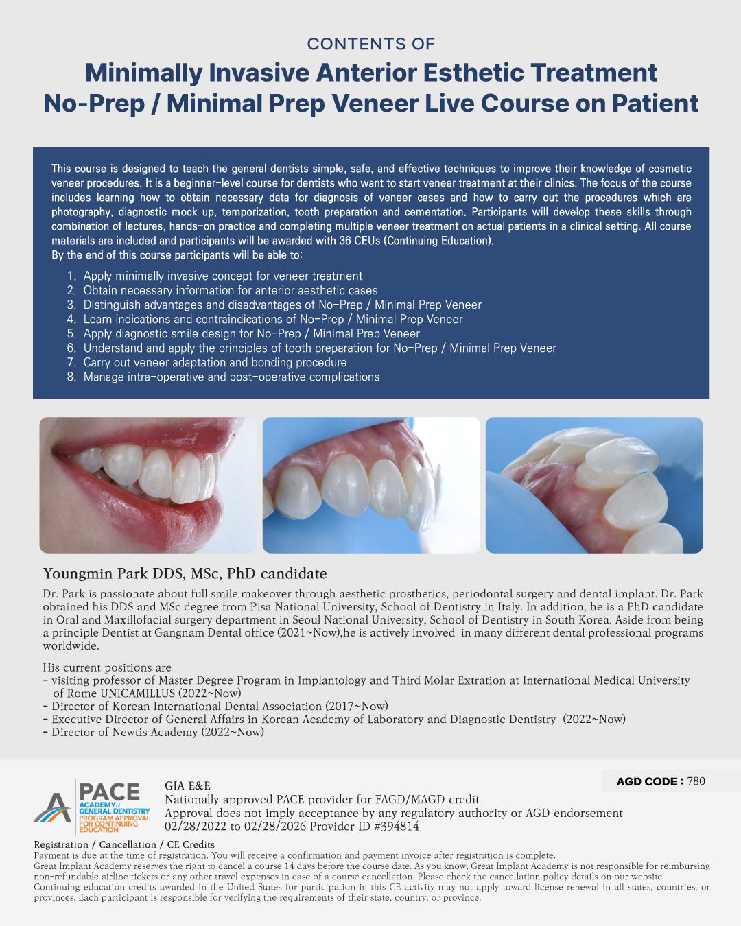 Mexico) No-Prep / Minimal Prep Veneer Live Course on Patient [October 8 - 12, 2025]